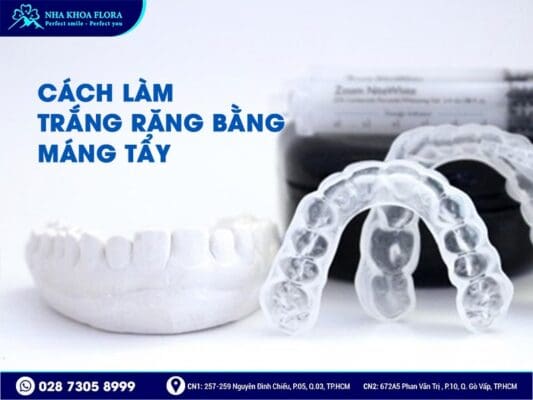 cách làm trắng răng - ảnh 4 cách làm trắng răng - ảnh 4