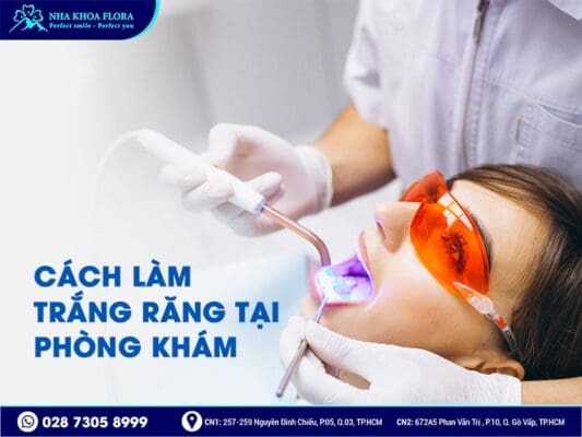 cách làm trắng răng - ảnh 5 cách làm trắng răng - ảnh 5