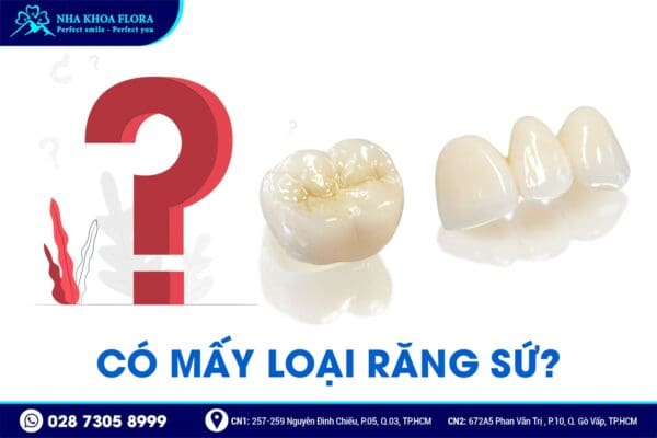 Nên bọc răng sứ loại nào? - Ảnh 1 Nên bọc răng sứ loại nào? - Ảnh 1