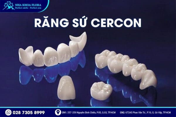 Nên bọc răng sứ loại nào? - Ảnh 4 Nên bọc răng sứ loại nào? - Ảnh 4