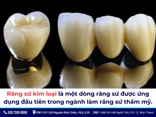 Tác hại của răng sứ kim loại - ảnh 1 Tác hại của răng sứ kim loại - ảnh 1
