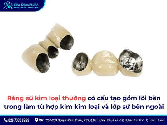 Tác hại của răng sứ kim loại - ảnh 2 Tác hại của răng sứ kim loại - ảnh 2