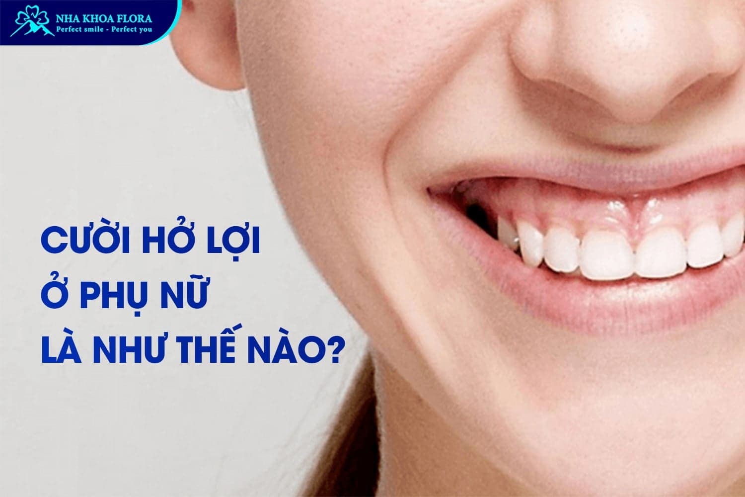 Phụ Nữ Cười Hở Lợi Tướng Số Là Tốt Hay Xấu? - ảnh 1 Phụ Nữ Cười Hở Lợi Tướng Số Là Tốt Hay Xấu? - ảnh 1