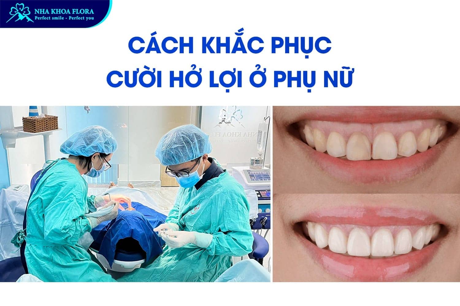Phụ Nữ Cười Hở Lợi Tướng Số Là Tốt Hay Xấu? - ảnh 3 Phụ Nữ Cười Hở Lợi Tướng Số Là Tốt Hay Xấu? - ảnh 3