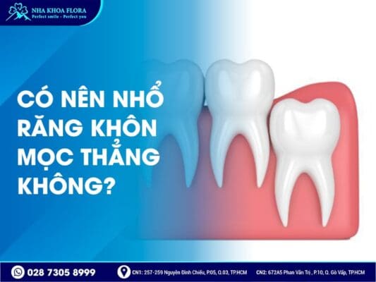 Có nên nhổ răng khôn - ảnh 2 Có nên nhổ răng khôn - ảnh 2