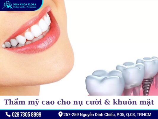 Lợi ích của trồng răng Implant - ảnh 1 Lợi ích của trồng răng Implant - ảnh 1