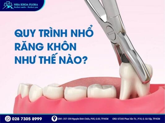quy trình nhổ răng khôn - ảnh 1 quy trình nhổ răng khôn - ảnh 1