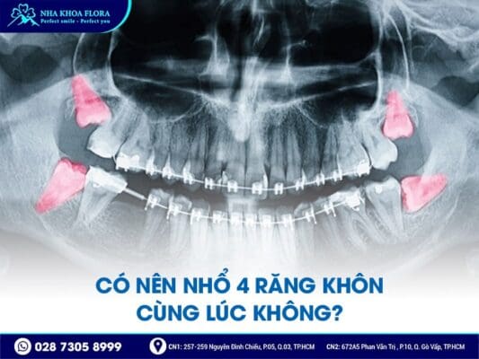 quy trình nhổ răng khôn - ảnh 3 quy trình nhổ răng khôn - ảnh 3