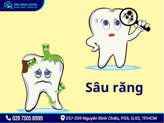 bệnh răng miệng - ảnh 1 bệnh răng miệng - ảnh 1