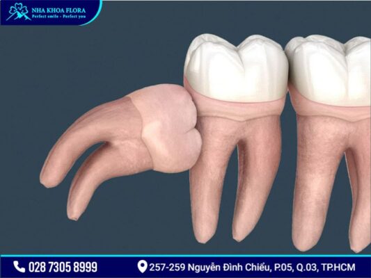 bệnh răng miệng - ảnh 9 bệnh răng miệng - ảnh 9
