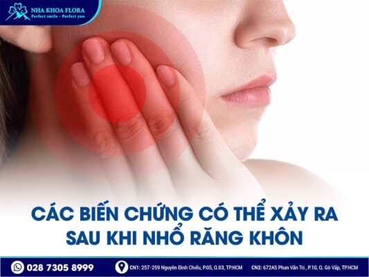 biến chứng sau khi nhổ răng khôn - ảnh 1 biến chứng sau khi nhổ răng khôn - ảnh 1