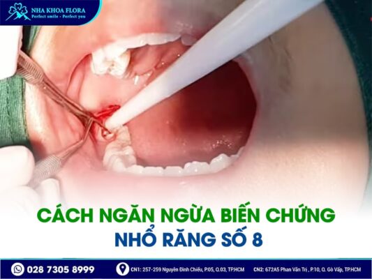 biến chứng sau khi nhổ răng khôn - ảnh 3 biến chứng sau khi nhổ răng khôn - ảnh 3