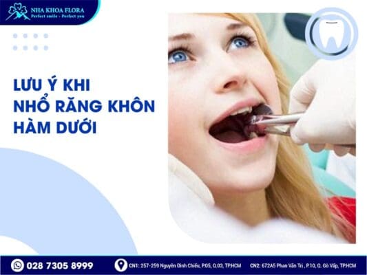 nhổ răng khôn hàm dưới - ảnh 4 nhổ răng khôn hàm dưới - ảnh 4