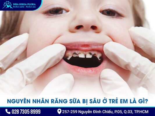 răng sữa bị sâu - ảnh 1 răng sữa bị sâu - ảnh 1