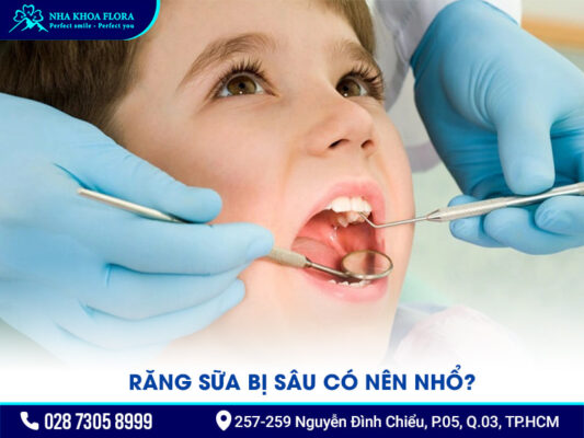 răng sữa bị sâu - ảnh 3 răng sữa bị sâu - ảnh 3