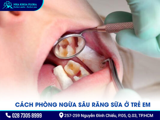 răng sữa bị sâu - ảnh 4 răng sữa bị sâu - ảnh 4