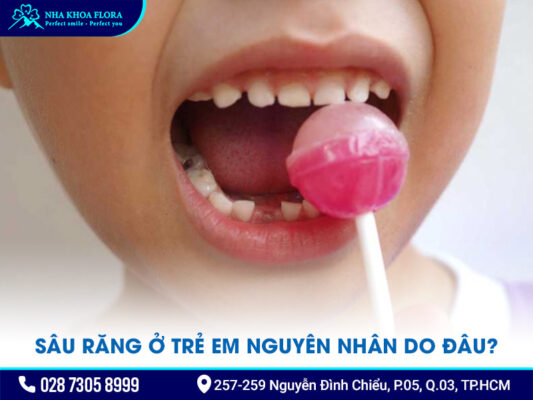 Sâu răng ở trẻ em - ảnh 1 Sâu răng ở trẻ em - ảnh 1