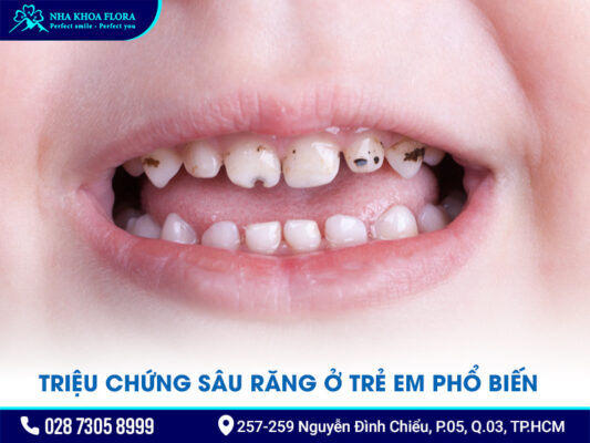 Sâu răng ở trẻ em - ảnh 2 Sâu răng ở trẻ em - ảnh 2