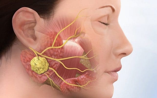 sau-rang-so-8 Sâu răng số 8 thi nên làm gì? Chữa trị hay Nhổ bỏ 4