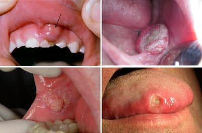 noi-so-nha-khoa nỗi sợ nha khoa