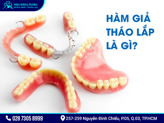 Nên cấy ghép Implant hay dùng hàm tháo lắp? - ảnh 2 Nên cấy ghép Implant hay dùng hàm tháo lắp? - ảnh 2