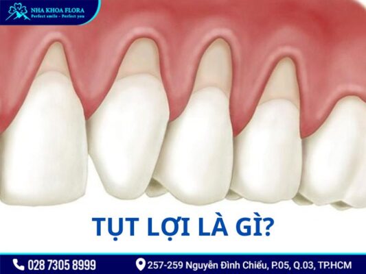 tụt lợi - ảnh 1 tụt lợi - ảnh 1