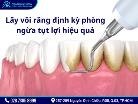 tụt lợi - ảnh 5 tụt lợi - ảnh 5