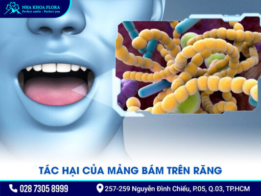 mảng bám trên răng - ảnh 2 mảng bám trên răng - ảnh 2