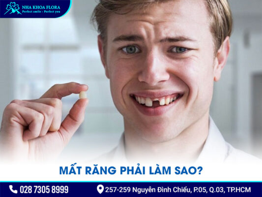 Nguyên nhân gây mất răng - ảnh 5 Nguyên nhân gây mất răng - ảnh 5
