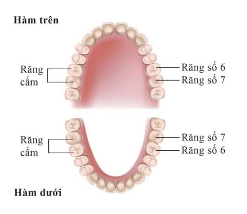 rang-cam răng cấm