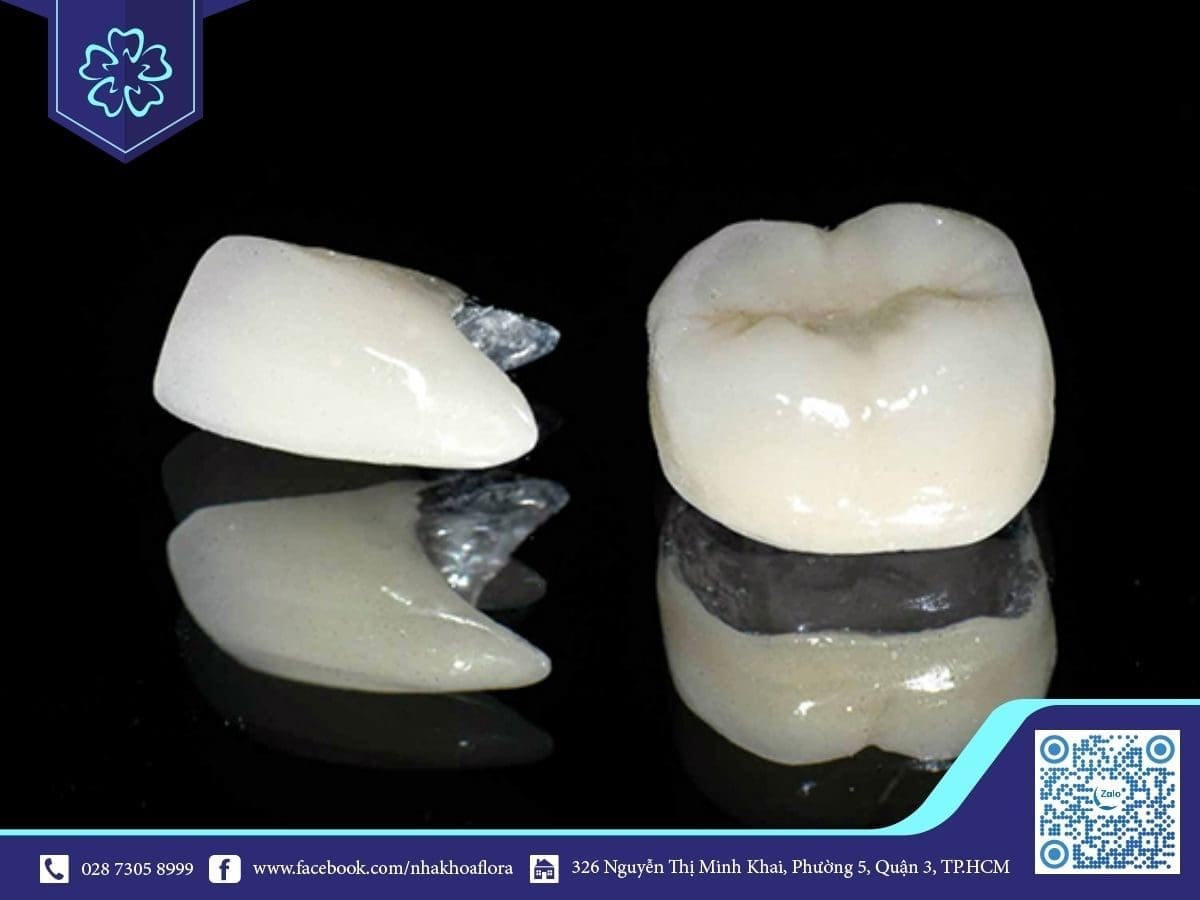 Mão sứ kém chất lượng (ảnh minh họa) Mão sứ kém chất lượng (ảnh minh họa)