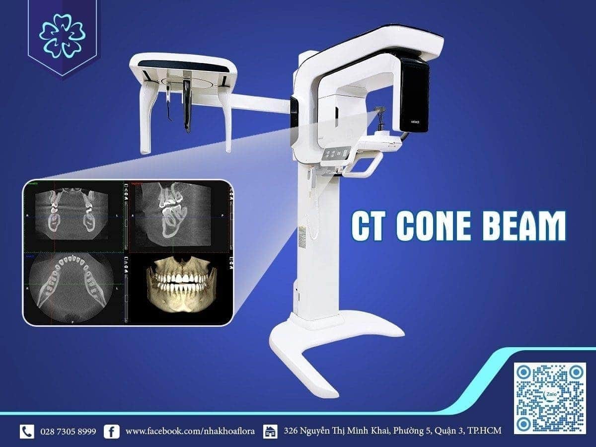 Máy CT Cone Beam tại Nha Khoa Flora - Thiết bị hỗ trợ cấy ghép răng Implant Máy CT Cone Beam tại Nha Khoa Flora - Thiết bị hỗ trợ cấy ghép răng Implant