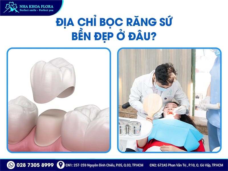 Bọc răng sứ có bền không? - Ảnh 5 Bọc răng sứ có bền không? - Ảnh 5