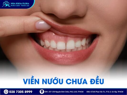 biến chứng sau phẫu thuật hở lợi - ảnh 3 biến chứng sau phẫu thuật hở lợi - ảnh 3