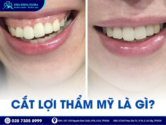 cắt lợi có đau không - ảnh 1 cắt lợi có đau không - ảnh 1