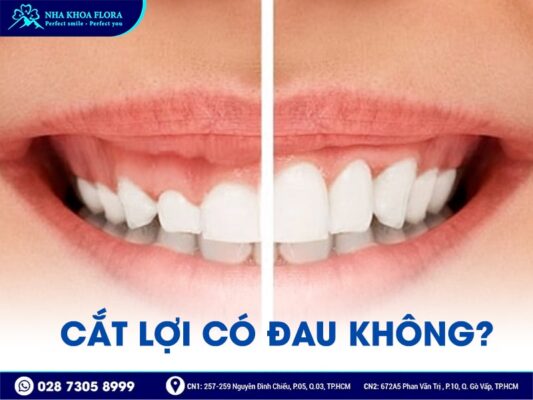 cắt lợi có đau không - ảnh 2 cắt lợi có đau không - ảnh 2