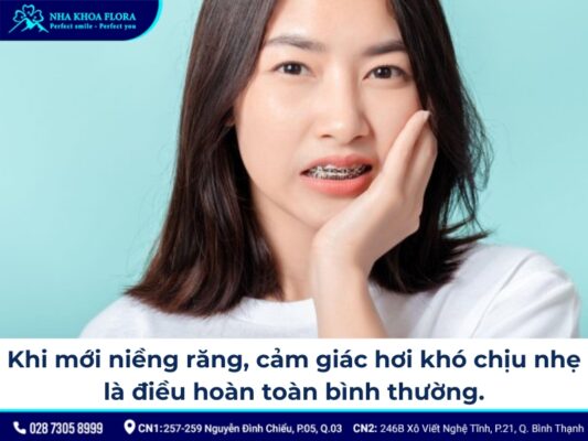 chia sẻ kinh nghiệm niềng răng - ảnh 1 chia sẻ kinh nghiệm niềng răng - ảnh 1