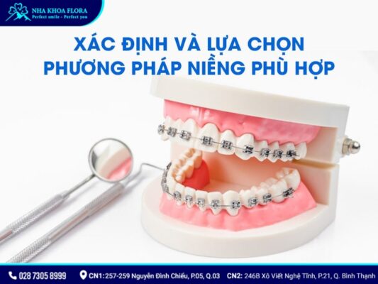 chia sẻ kinh nghiệm niềng răng - ảnh 2 chia sẻ kinh nghiệm niềng răng - ảnh 2