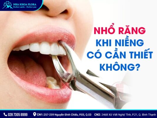 chia sẻ kinh nghiệm niềng răng - ảnh 4 chia sẻ kinh nghiệm niềng răng - ảnh 4