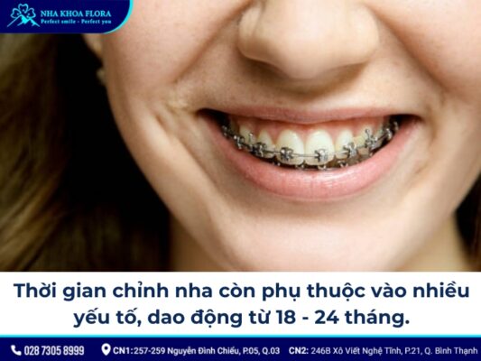 chia sẻ kinh nghiệm niềng răng - ảnh 6 chia sẻ kinh nghiệm niềng răng - ảnh 6