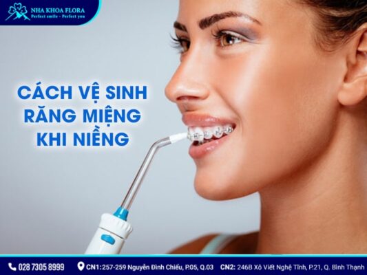 chia sẻ kinh nghiệm niềng răng - ảnh 7 chia sẻ kinh nghiệm niềng răng - ảnh 7