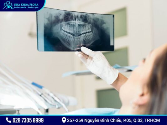 chụp x quang trước khi niềng răng - ảnh 1 chụp x quang trước khi niềng răng - ảnh 1
