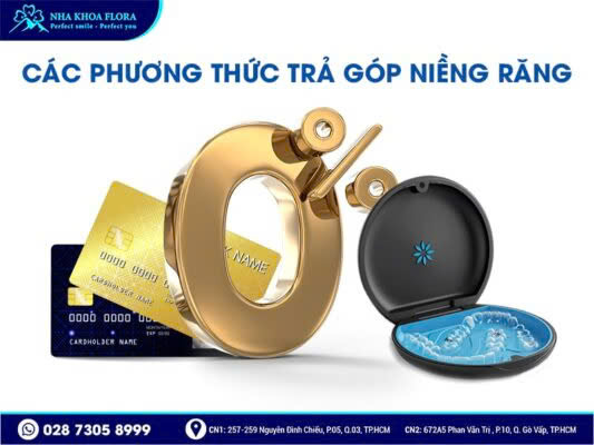 niềng răng trả góp - ảnh 2 niềng răng trả góp - ảnh 2