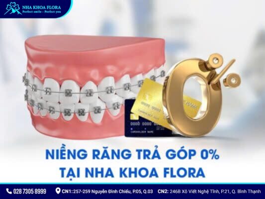 niềng răng trả góp - ảnh 6 niềng răng trả góp - ảnh 6
