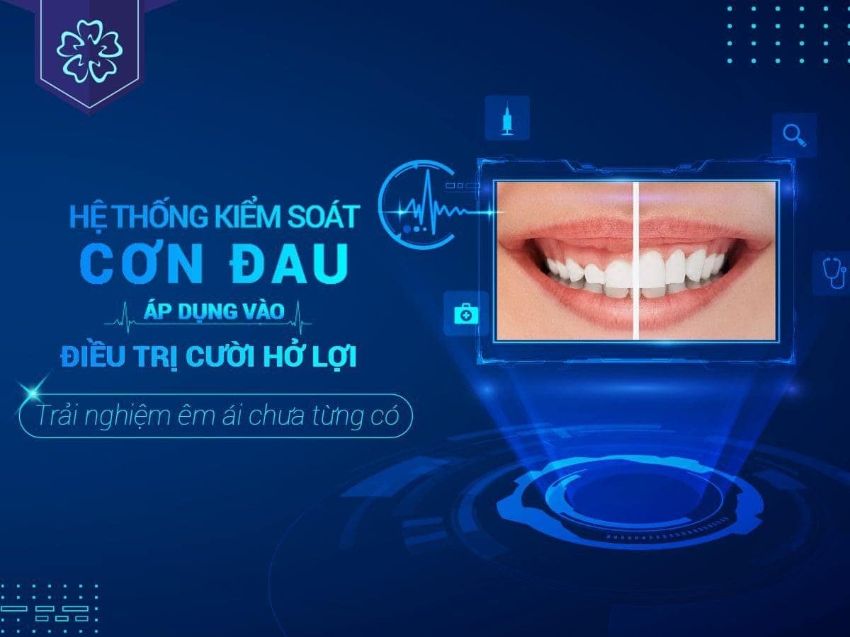 cắt lợi kiêng ăn gì? - Ảnh 1 cắt lợi kiêng ăn gì? - Ảnh 1