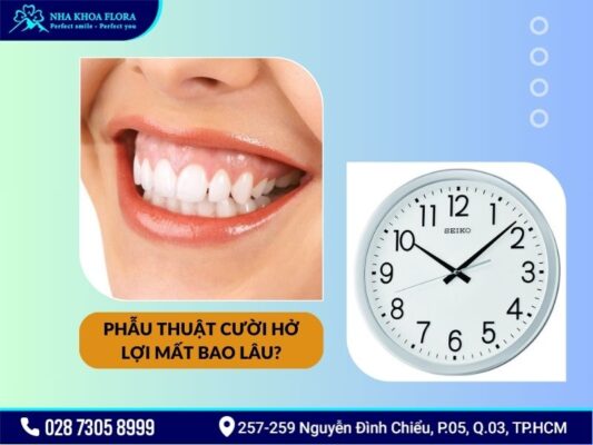 phẫu thuật cười hở lợi mất bao lâu - ảnh 1 phẫu thuật cười hở lợi mất bao lâu - ảnh 1