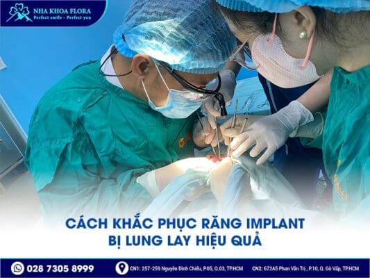 trụ implant bị lung lay - ảnh 5 trụ implant bị lung lay - ảnh 5