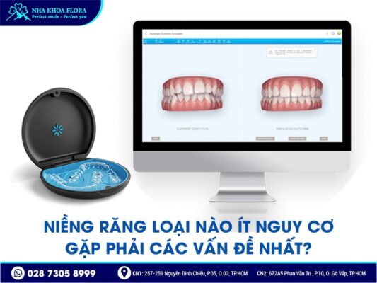 Các vấn đề thường gặp khi niềng răng - ảnh 3 Các vấn đề thường gặp khi niềng răng - ảnh 3