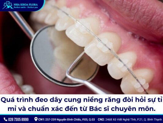 dây cung niềng răng - ảnh 4 dây cung niềng răng - ảnh 4
