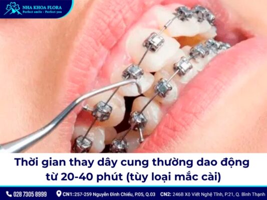 dây cung niềng răng - ảnh 5 dây cung niềng răng - ảnh 5